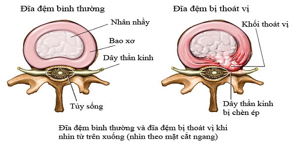 dia dem bi ton thuong